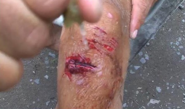Accident de surf à Teahupoo : Brian Conley victime d’une plaie sur le reef