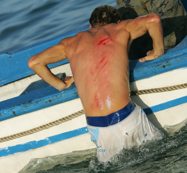 Quels sont les risques liés au surf ? Comment les prévenir ?